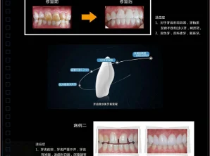 病例